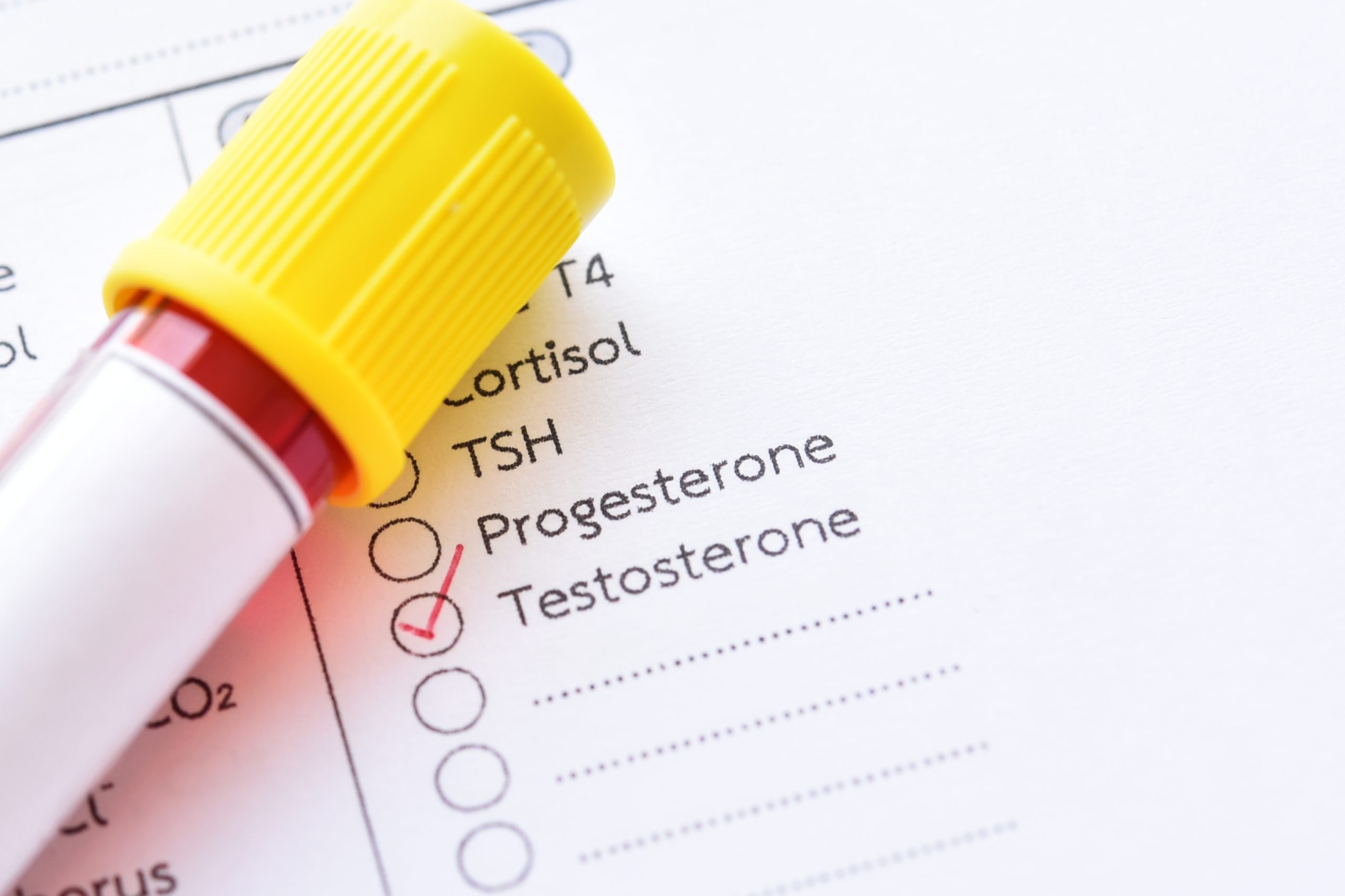 Andropause: Fundamentals About Low Testosterone